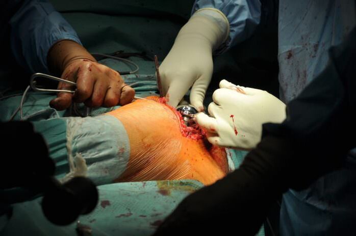 Surgical