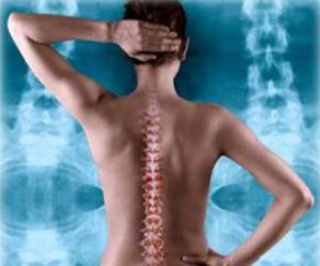 Illustration of the back spine