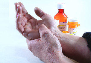 methods of treating arthritis and arthrosis