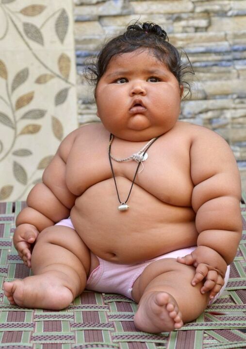 Excess body weight causes arthrosis