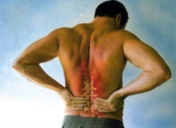 Pain for lumbar osteochondrosis